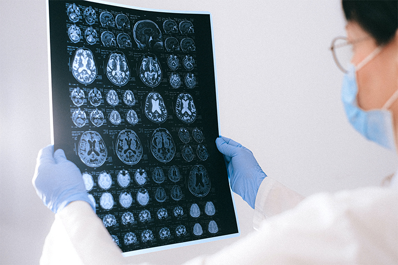 Brain X-rays