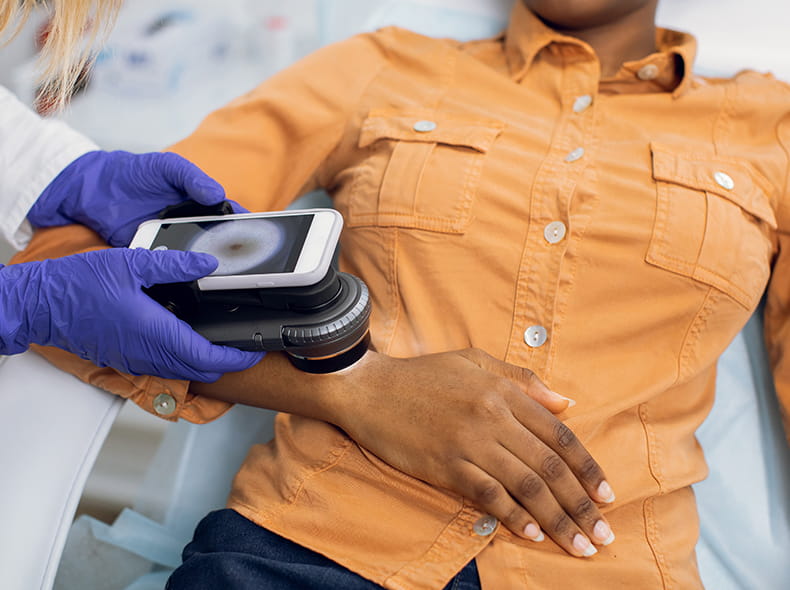 Micrographic Surgery and Dermatologic Oncology