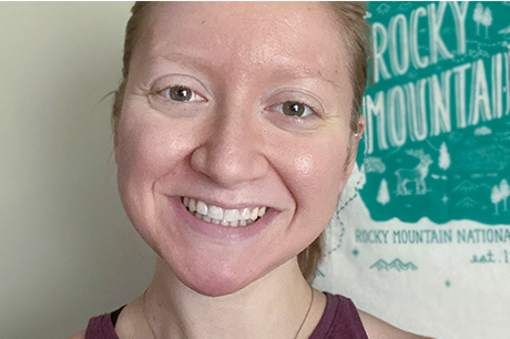 Kayleigh without glasses on now after lasik surgery