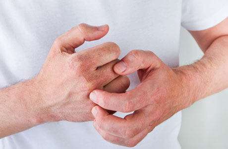 A man scratching his hand. 