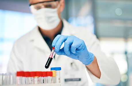 lab specialist with a blood vial